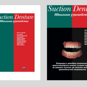 Suction Denture. Идеальное руководство